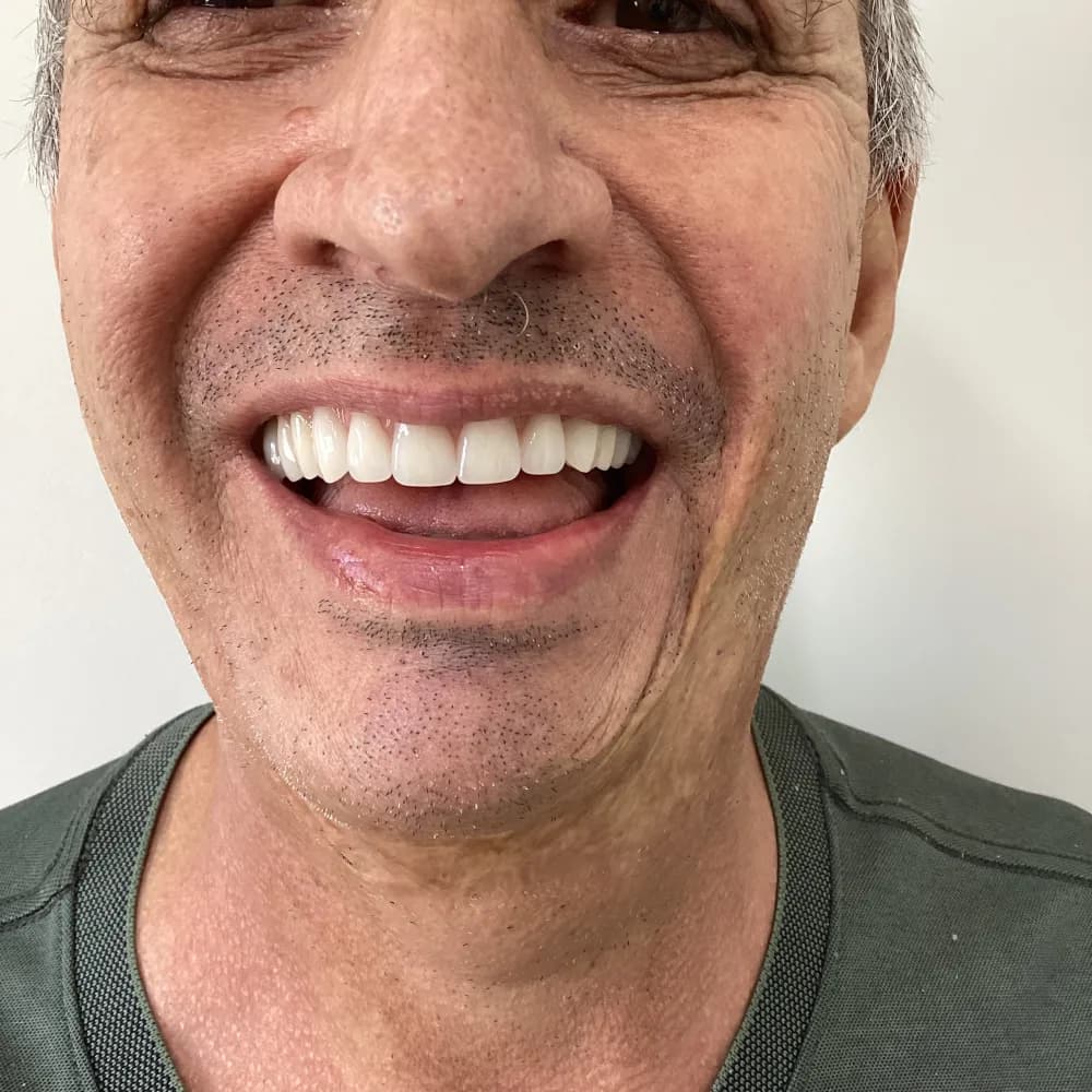 Cliente Ornare sorrindo