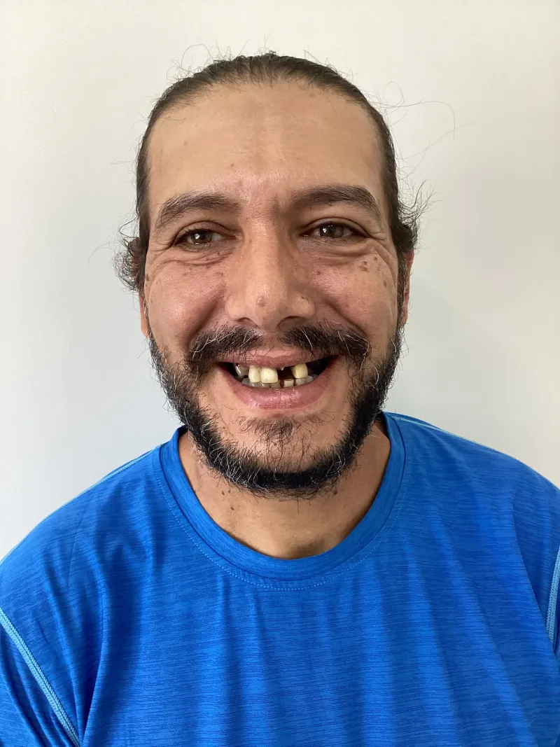 Antes